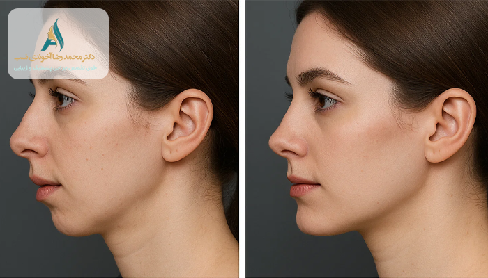 تغییرات چهره بعد از جراحی فک
