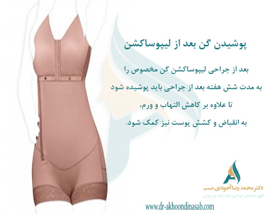 پوشیدن-گن-بعد-از-جراحی-لیپوساکشن