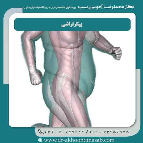 پیکرتراشی