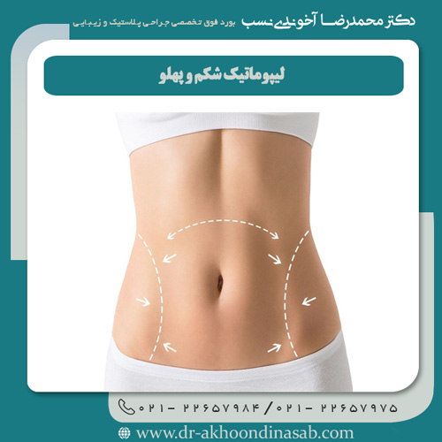 لیپوماتیک شکم و پهلو