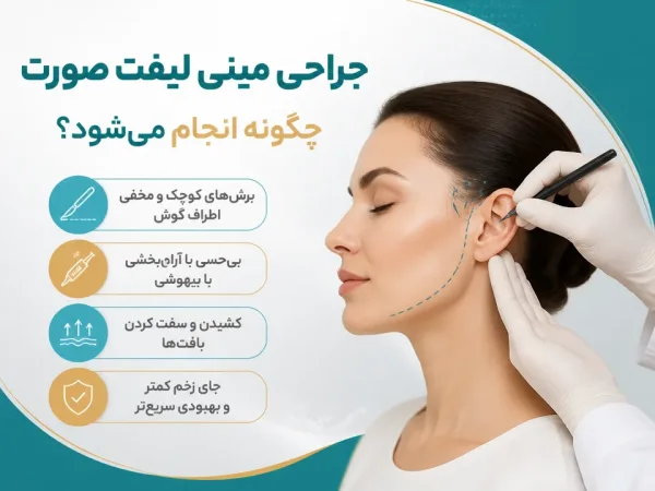 مینی لیفت صورت چگونه انجام میشود و چه مراحلی دارد — طراحی محل برش و اصلاح خط فک در جراحی مینی لیفت صورت